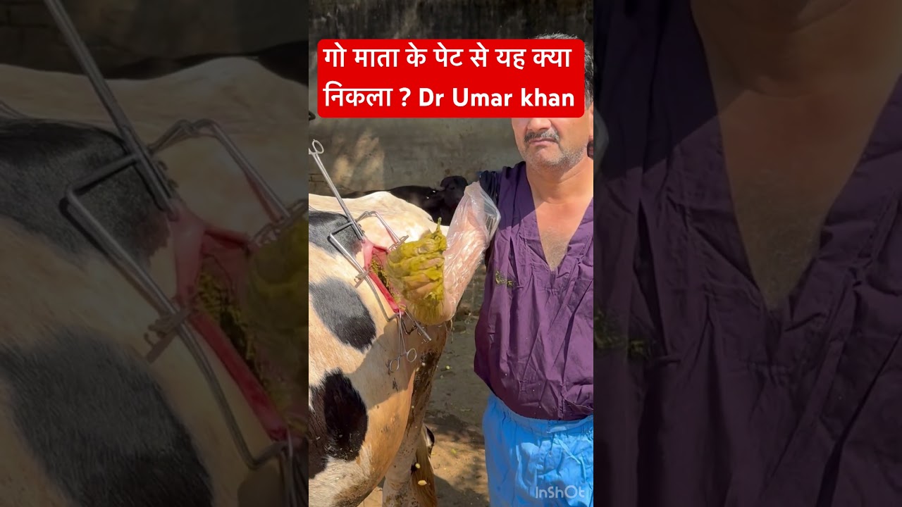 Rumenotomy l dr Umar khan