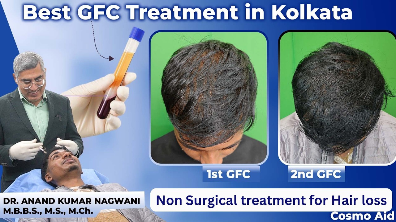 Best GFC Treatment in Kolkata | Non Surgical treatment for Hair loss by Dr Nagwani | Cosmo aid