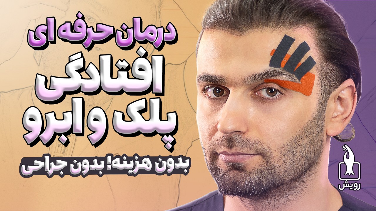 درمان افتادگی پلک و ابرو بدون جراحی | بهترین درمان خانگی افتادگی پلک و ابرو