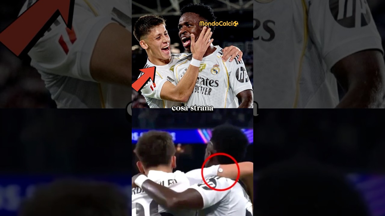 Perché Arda Güler indossava un dispositivo strano sul braccio durante la partita? 😳🤔