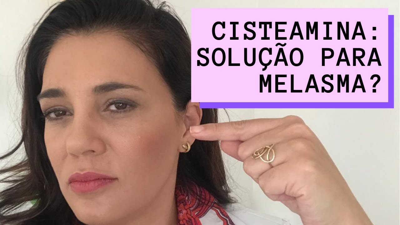 🔈CISTEAMINA: É A SOLUÇÃO PARA O MELASMA?