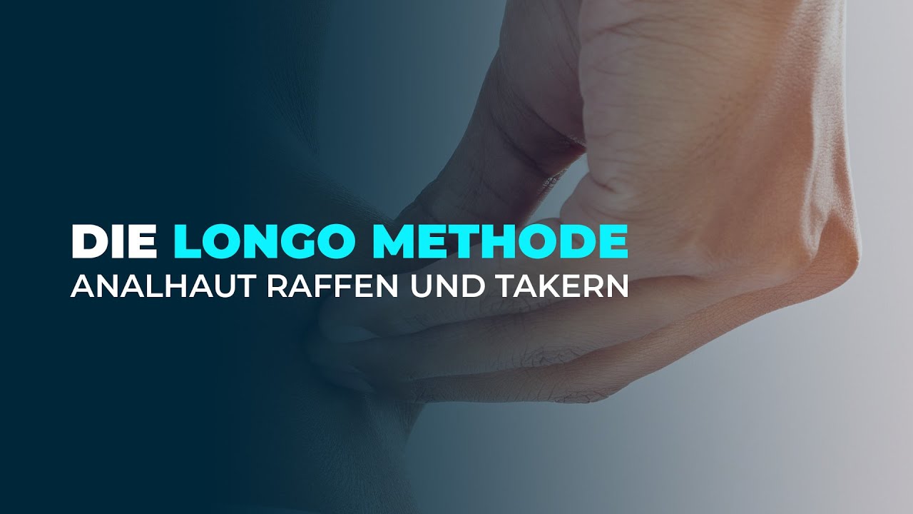 SCHMERZSYNDROM nach LONGO OP! Dr. Eduard Karsten klärt auf