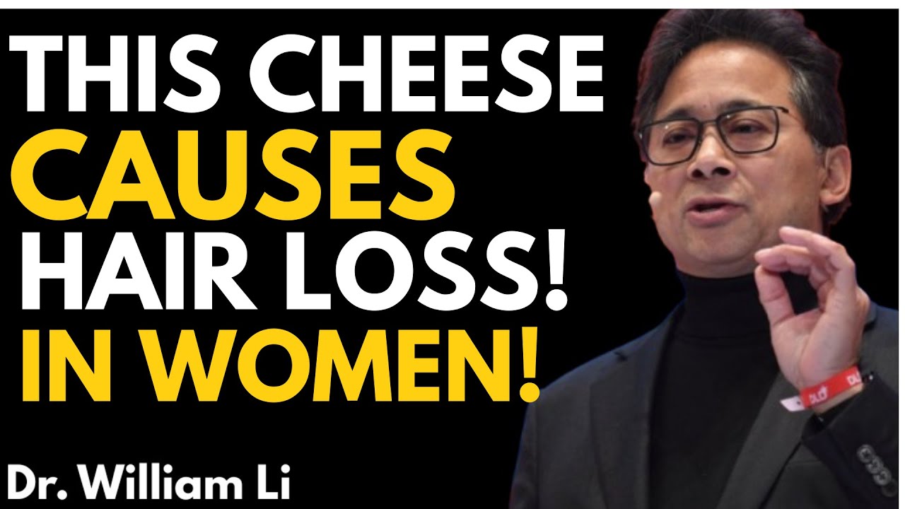 Avoid This Cheese or Lose Hair Fast | Dr .William Li