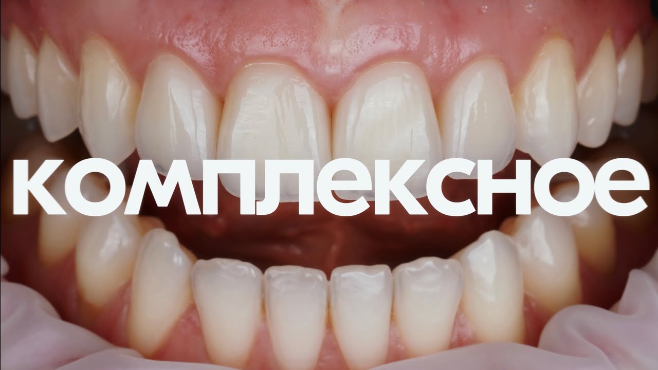 Комплексное лечение. Основные принципы. aikdent.school