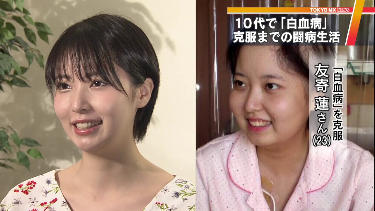 白血病の闘病生活とは？　克服した女優が語る