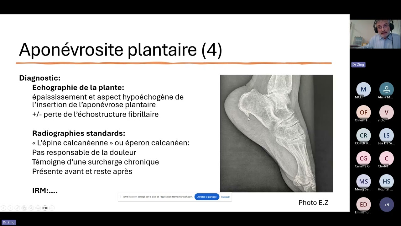 20250604 Les atteintes du pied les plus fréquentes en rhumatologie
