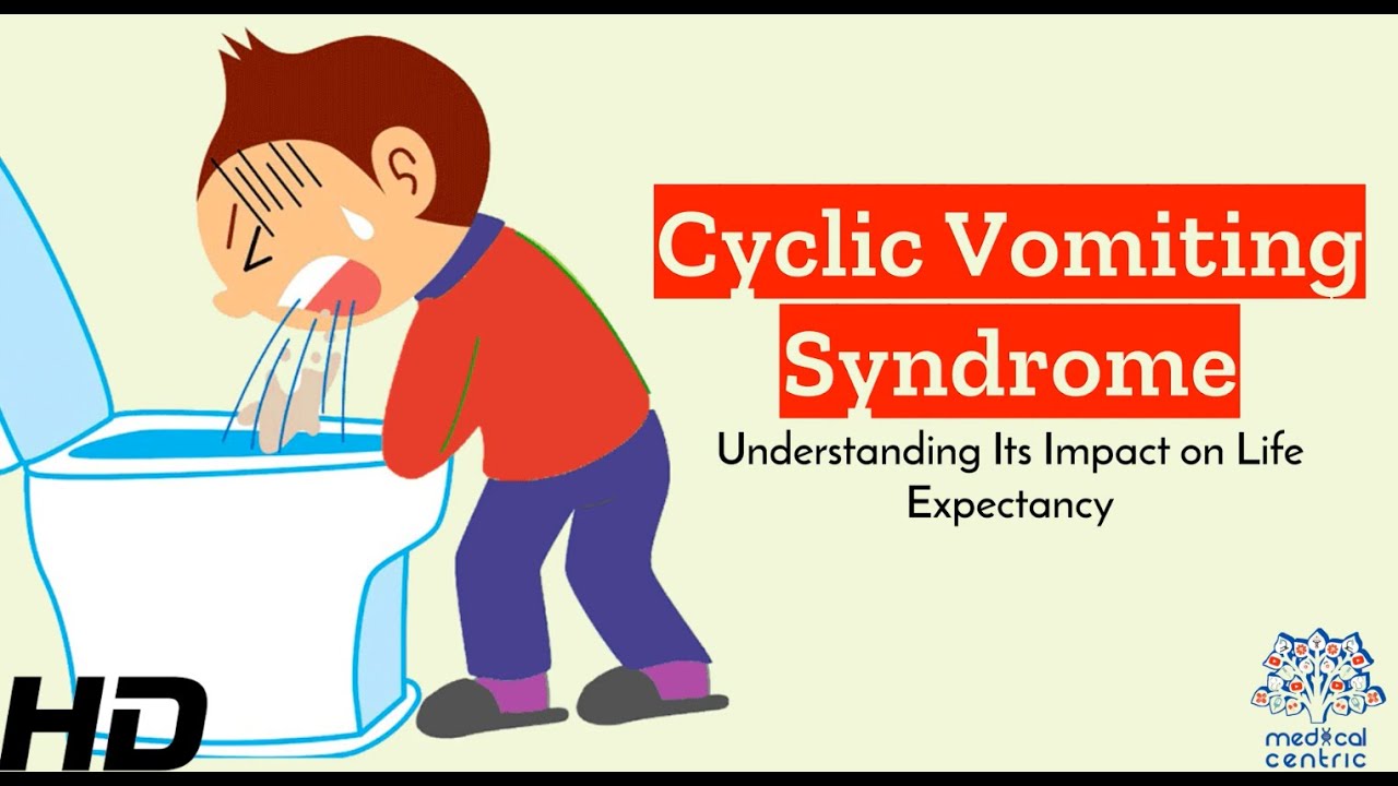 Cyclic Vomiting Syndrome: Unraveling its Impact on Life Expectancy