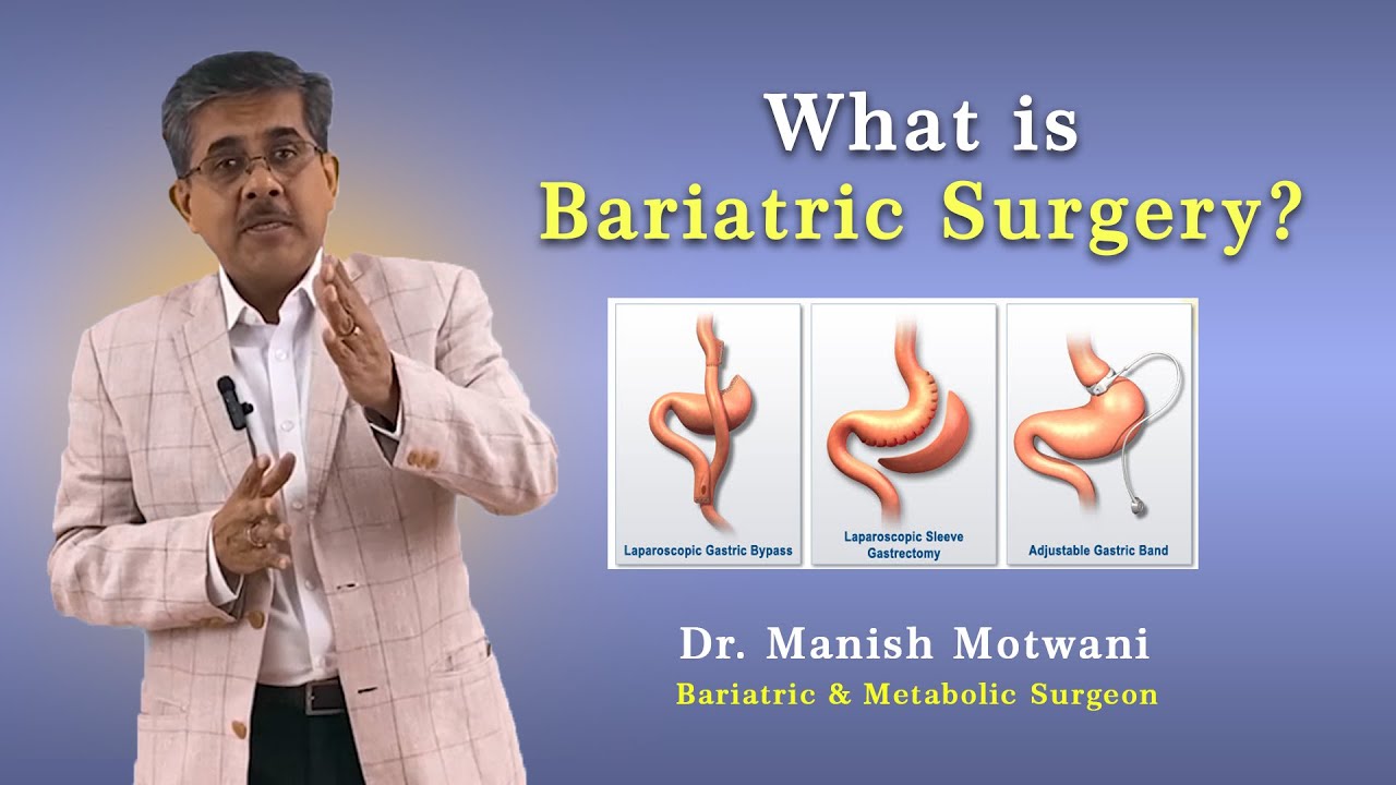 Bariatric Weight Loss Surgery (Hindi) - Dr. Manish Motwani