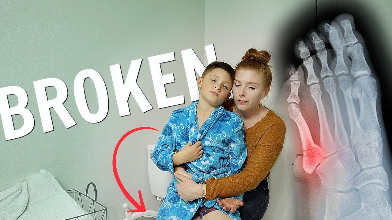 an update on my son's BROKEN foot