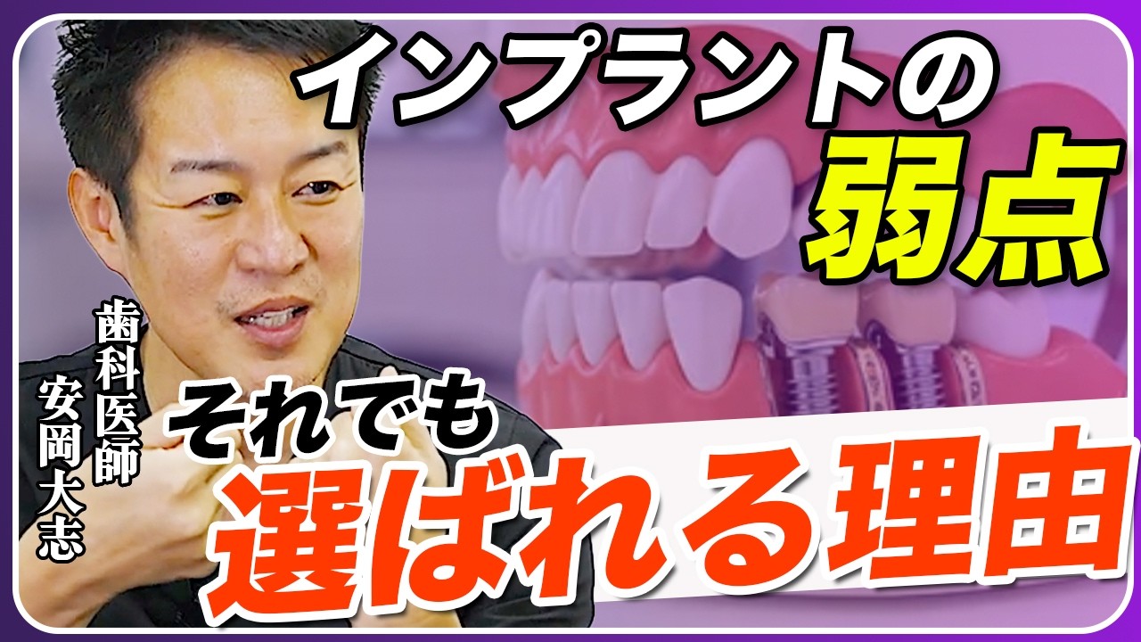 インプラントは本当に危険なの？デメリットと真実を話します