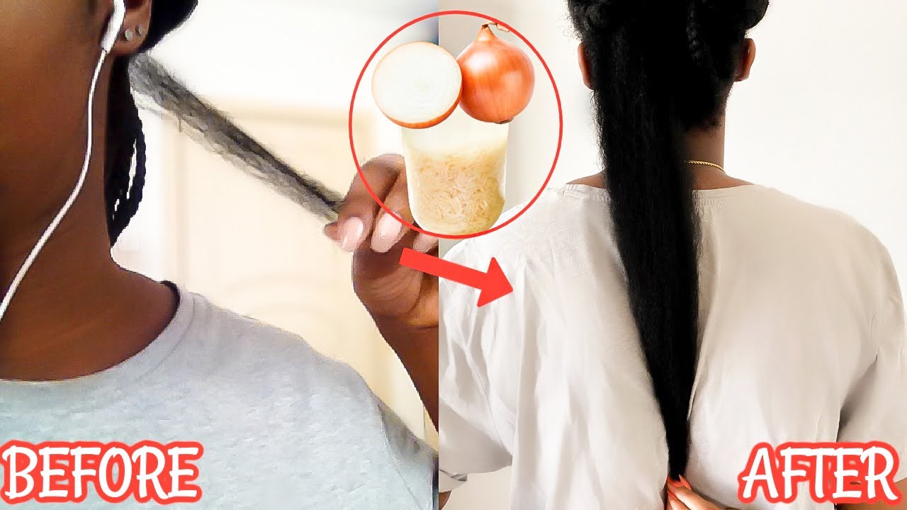 HOW I GREW MY HAIR IN JUST 2 MONTHS WITH RICE WATER & ONION JUICE!!!| GROW LONG AND THICK HAIR