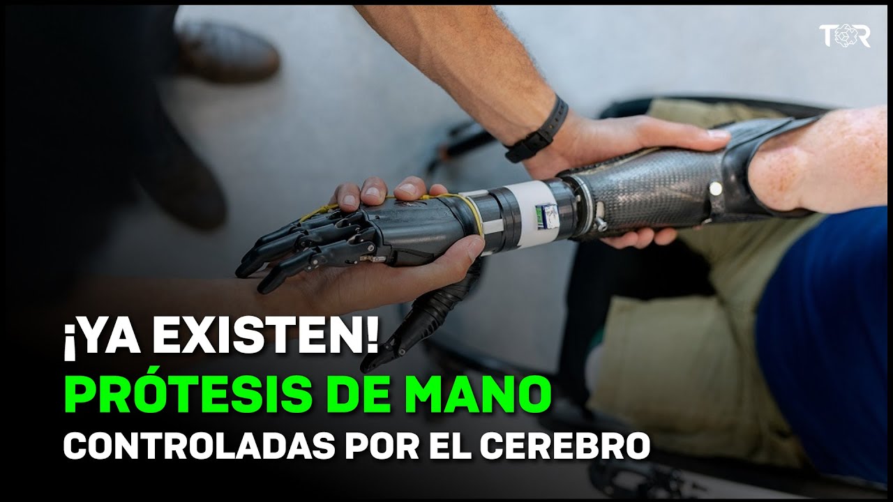¡Ya existen! Prótesis de mano controladas por el cerebro