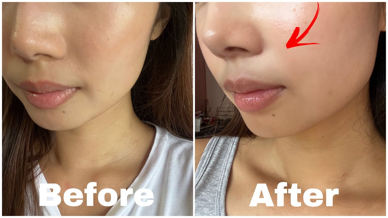 ZIIP HALO FACIAL TONING DEVICE REVIEW | Before & After Pics! BEST Anti-aging At Home Device