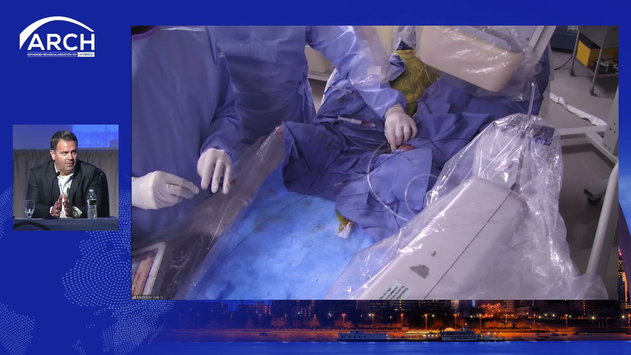 Arch - Peripheral Live Case (April 2021)