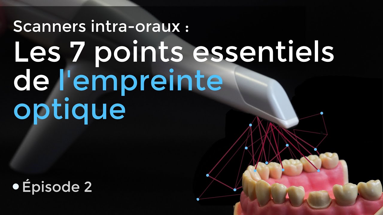 Empreinte optique dentaire - les 7 points essentiels