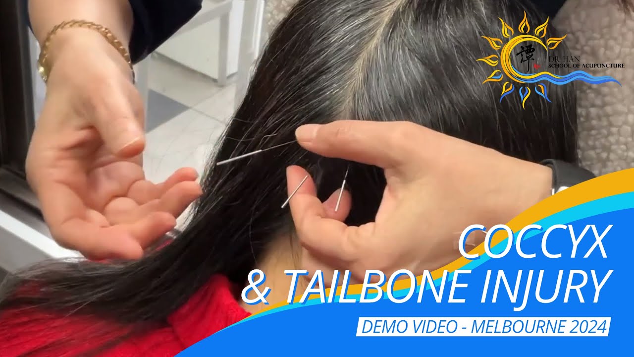 Coccyx Tailbone Injury #譚針 #韓玉齡 #eileenhan #DrtanBalanceMethod #正宗譚針 #tailbone #coccyxpain