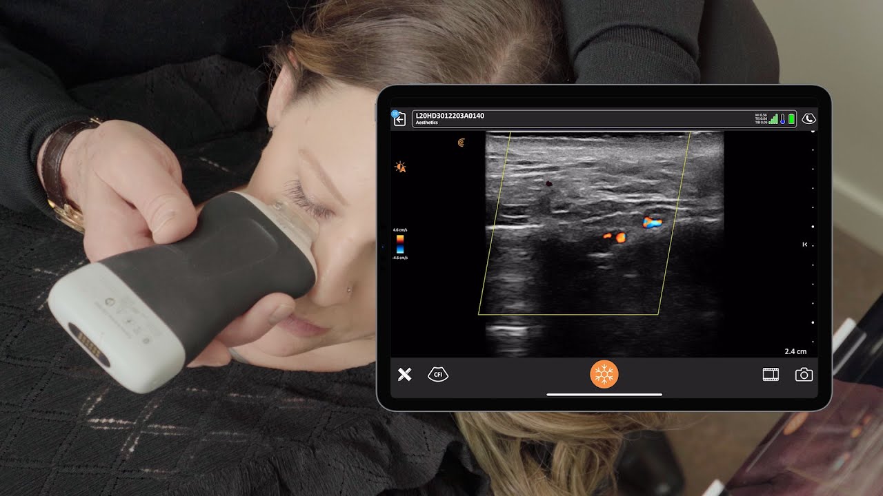 Ultrasound of the Midface