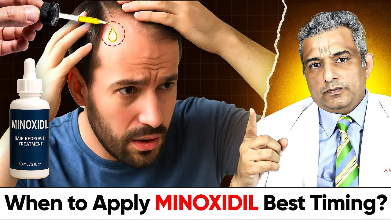 MINOXIDIL Best Timing - Receding Hairline, Male Pattern Baldness, Minoxidil Hair Regrowth Result