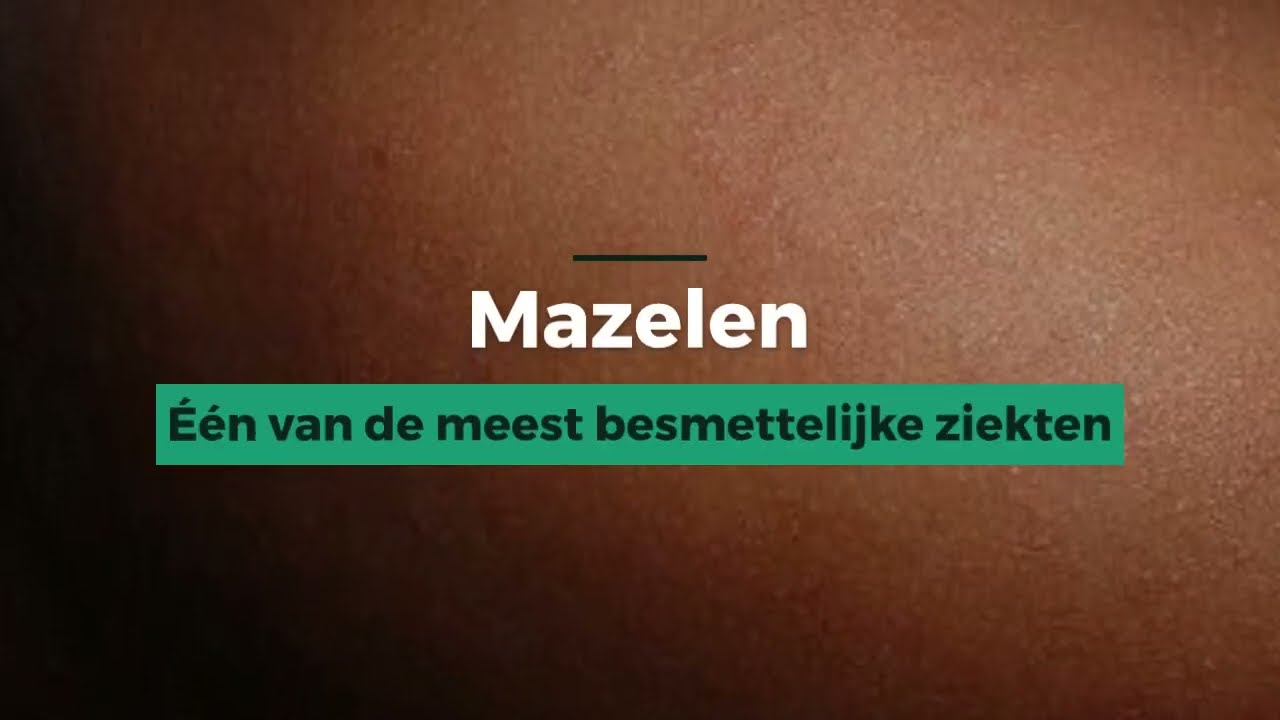Mazelen