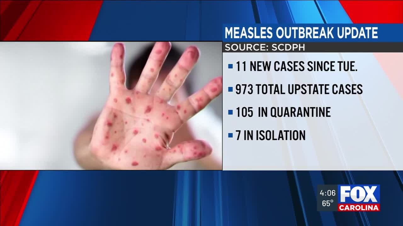 Officials identify additional school, public exposures in Upstate measles outbreak