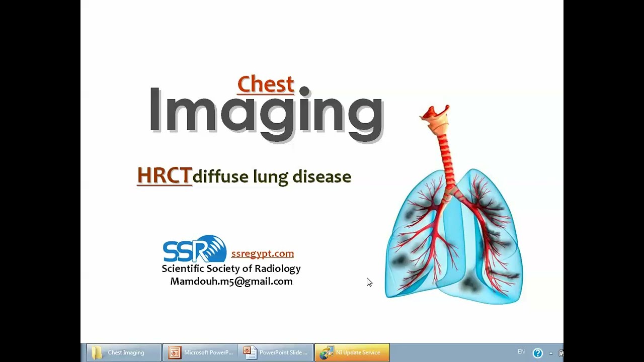 HRCT of diffuse lung disease (I) (DRE) Prof. Mamdouh Mahfouz