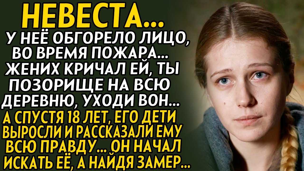 💗ИСТОРИЯ ВАС ШОКИРУЕТ. Невеста с обгоревшим лицом. Спустя 18 лет, дети прочитали завещание и замерли