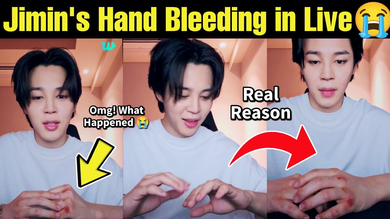Jimin's Hand Bleeding in Live 🔴 Omg! What Happened To Jimin 😭 #bts #jimin #live #kpop #jungkook #v