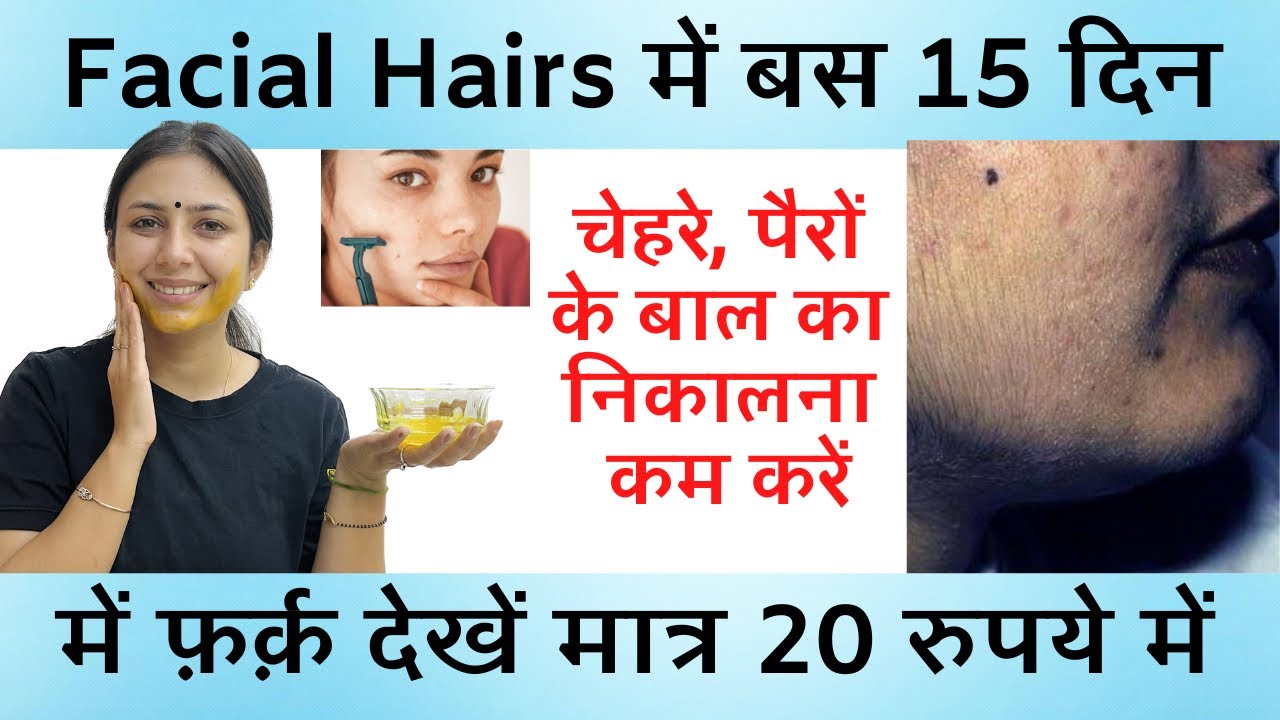 Reduce Facial Hair without Laser | Unwanted Facial Hair | PCOD Facial Hair | Dr. Upasana Vohra