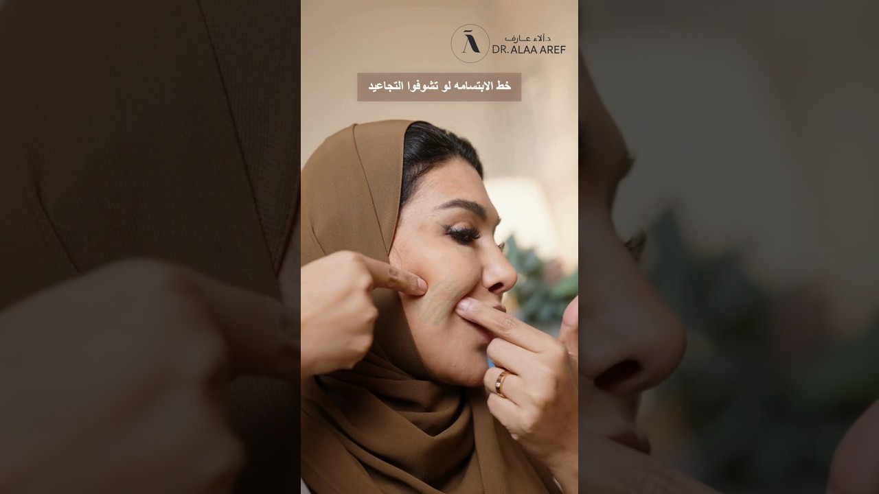 تجاعيد الخد