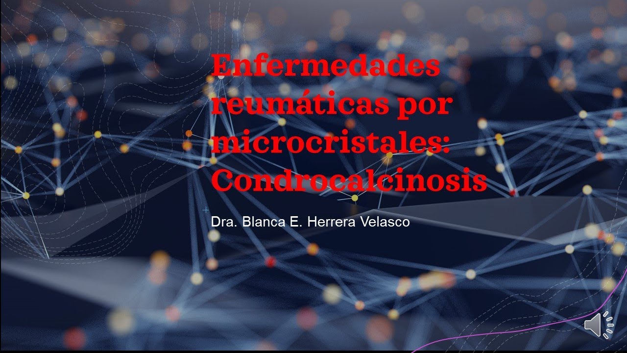Condrocalcinosis
