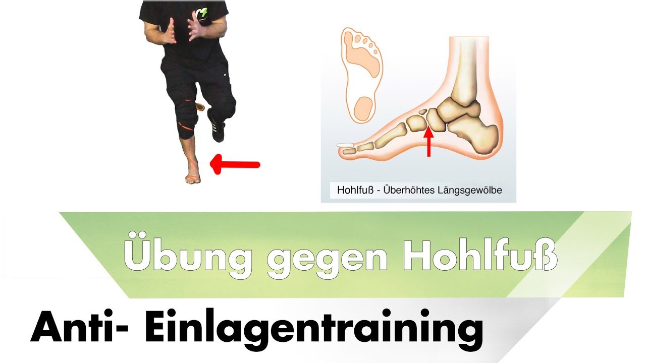 Übungen gegen Hohlfuß | Einlagen bringen nichts | #Läuferknie