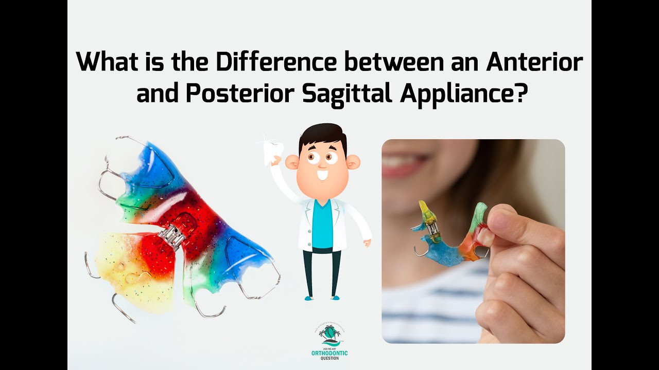 Anterior vs Posterior Sagittal Appliance