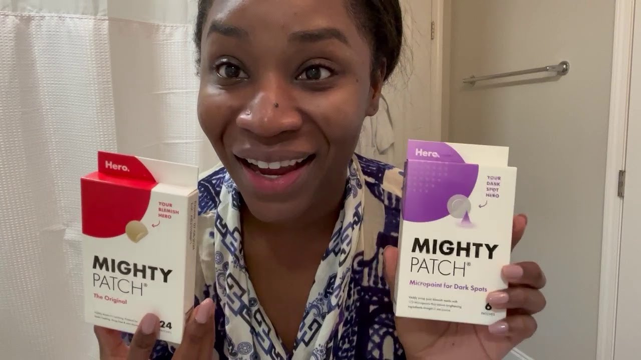 Mighty Patch Review. Do they work? | Poppin or Floppin!