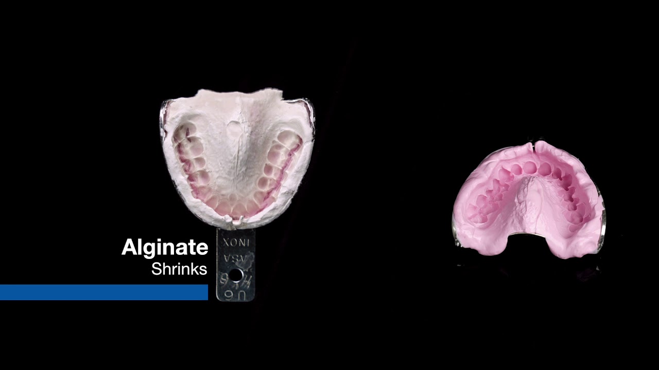Silginat from Kettenbach the Standard for all alginate applications