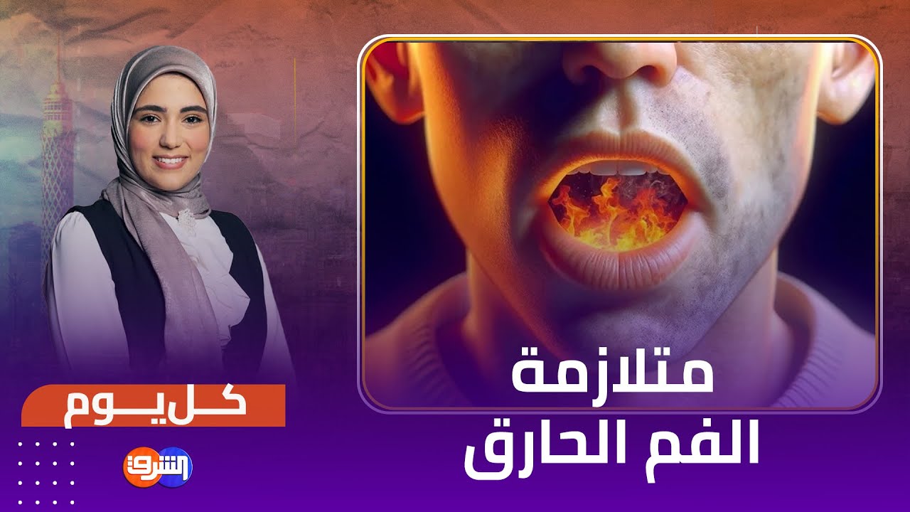 متلازمة الفم الحارق .. الأسباب والمخاطر ، د. مصطفى جاويش يوضح التفاصيل