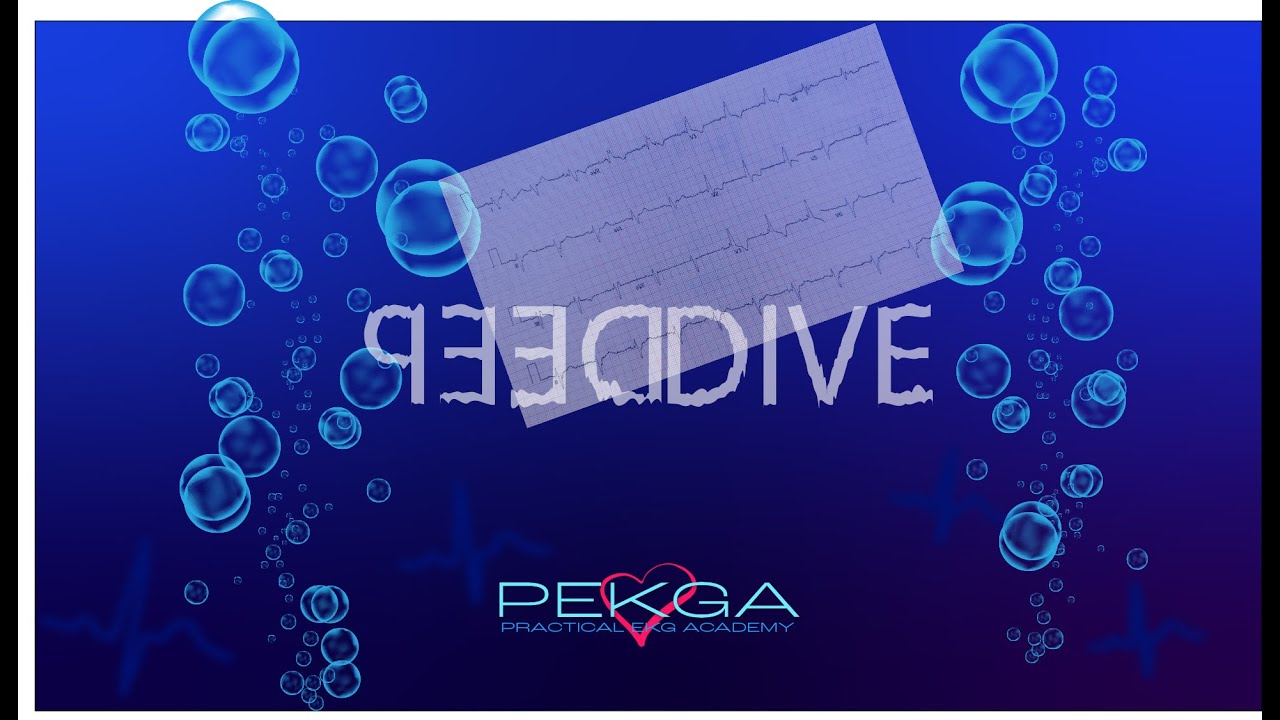 DEEP DIVE TOF PEKGA - TETRALOGY OF FALLOT