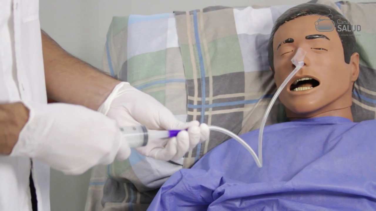 Nutrición enteral por sonda nasogástrica