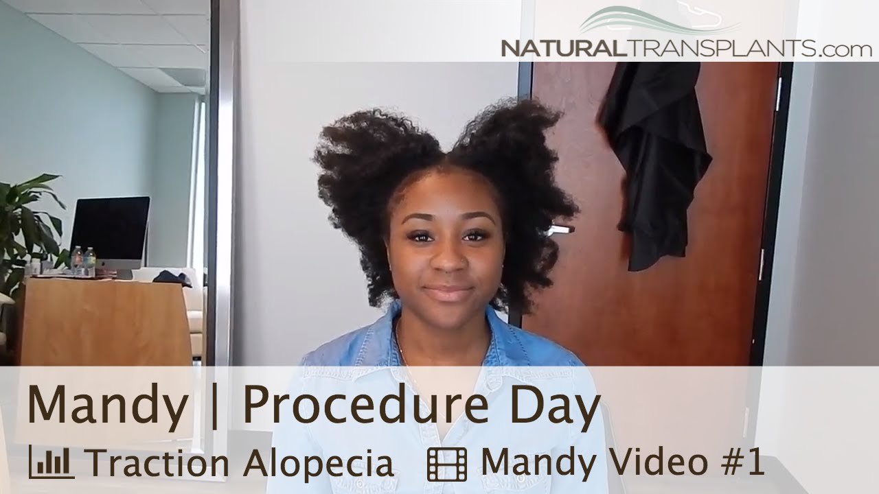 Traction Alopecia Regrowth | Alopecia Cure Natural (Mandy)