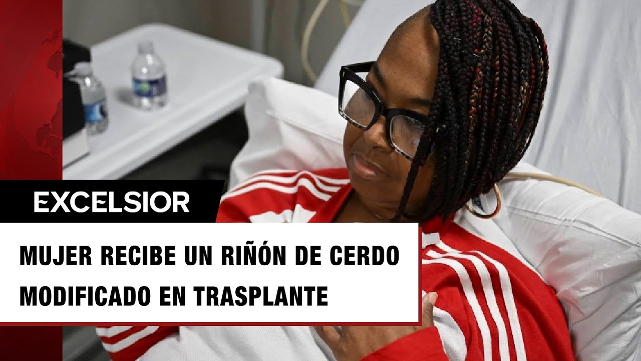 Mujer recibe un ri&ntilde;&oacute;n de cerdo modificado en trasplante experimental