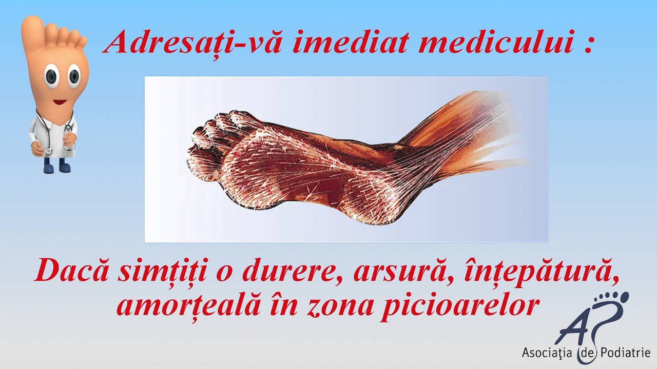 Educatie Picior diabetic