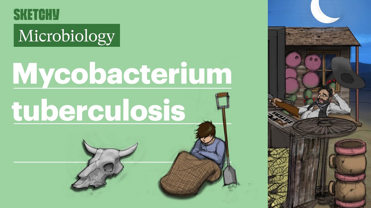 Mycobacterium Tuberculosis (Microbiology) | USMLE Step 1 | Sketchy Medical
