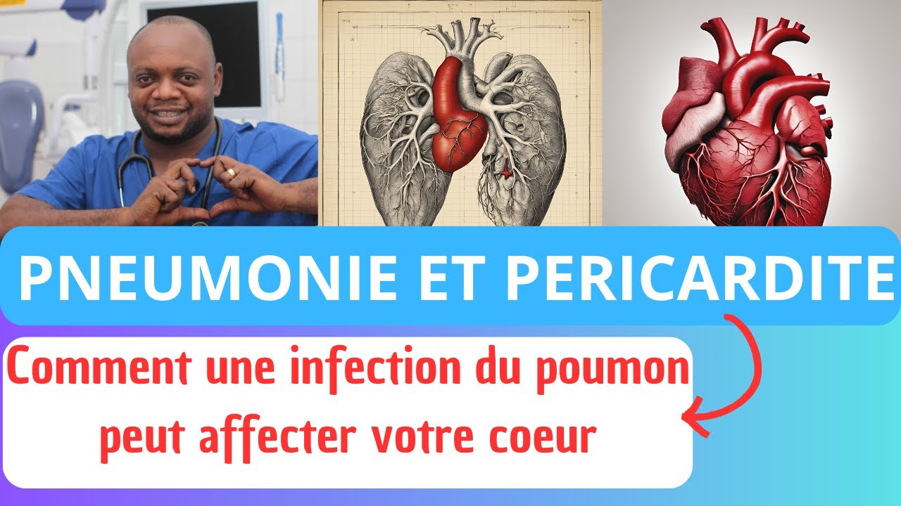 Pneumonie et Péricardite : Comment une Infection Pulmonaire Peut Affecter Votre Cœur