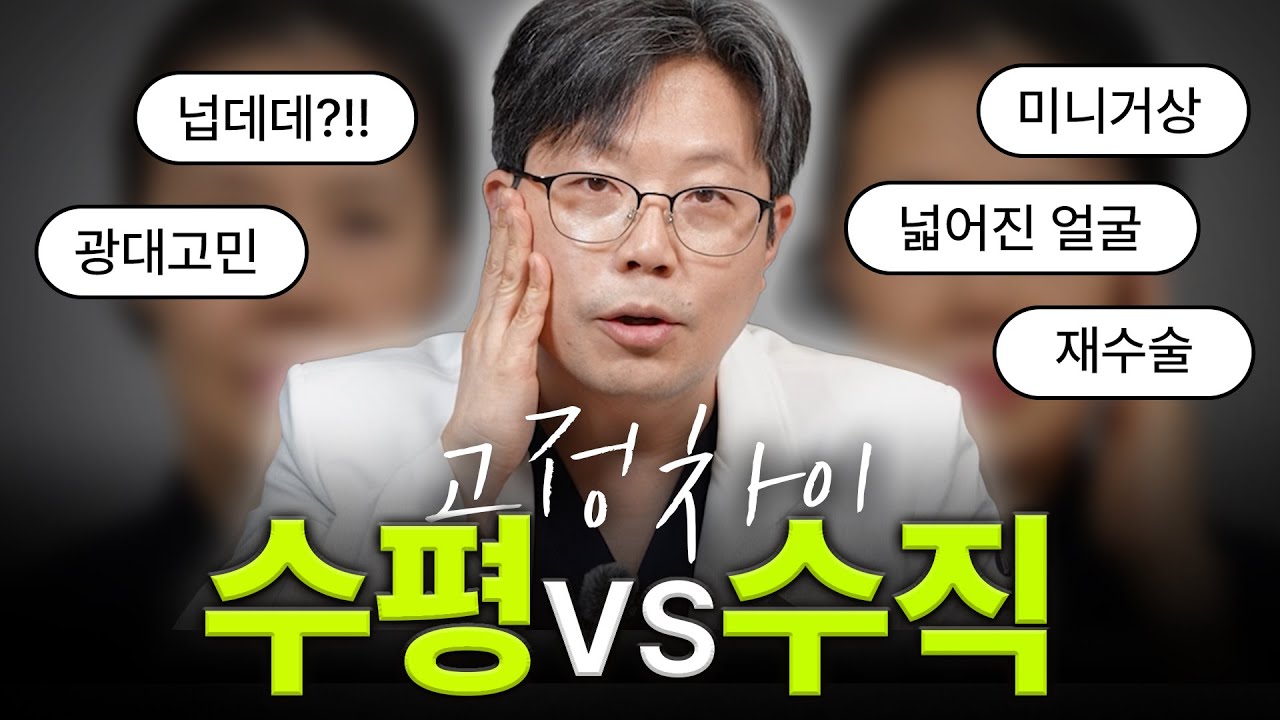 수평고정 vs 수직고정, 거상에서 어떤 방향이 더 효과적일까?