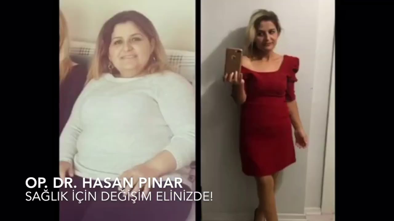 Mide Küçültme Ameliyatı Sonrası Muhteşem Değişimler