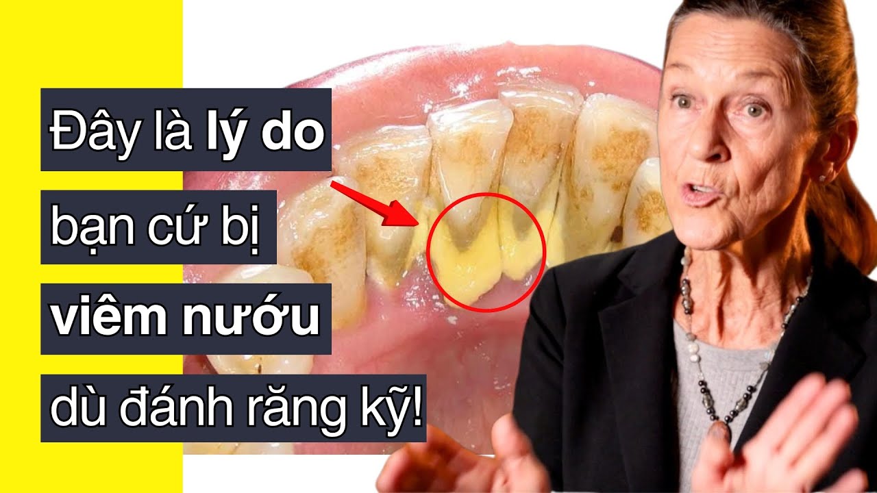 #1 Cách Hiệu Quả Nhất Giúp Làm Sạch Mảng Bám Răng (CAO RĂNG)! Dr. Ellie Phillips