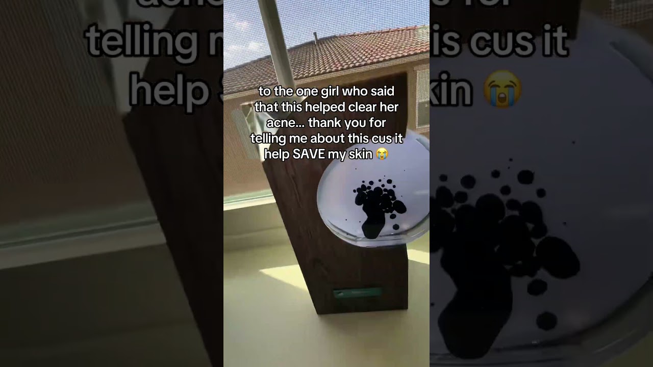 Even My Esthetician Approved This #skincaretips #SkinCare101