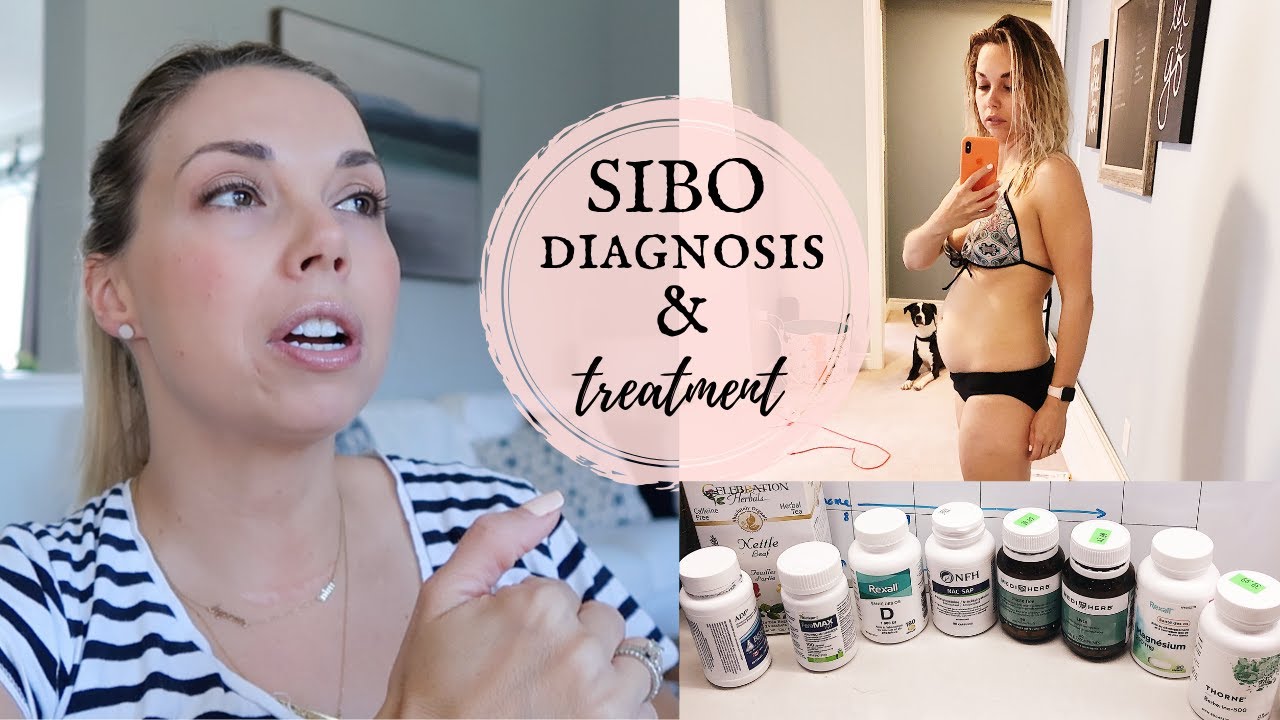 SIBO Diagnosis and Treatment | Diverticulitis Update | Digestive Health