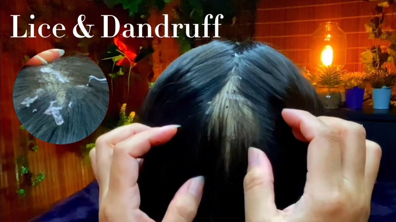ASMR Sis Help You, Remove Lice & Dandruff 😴💤🥱
