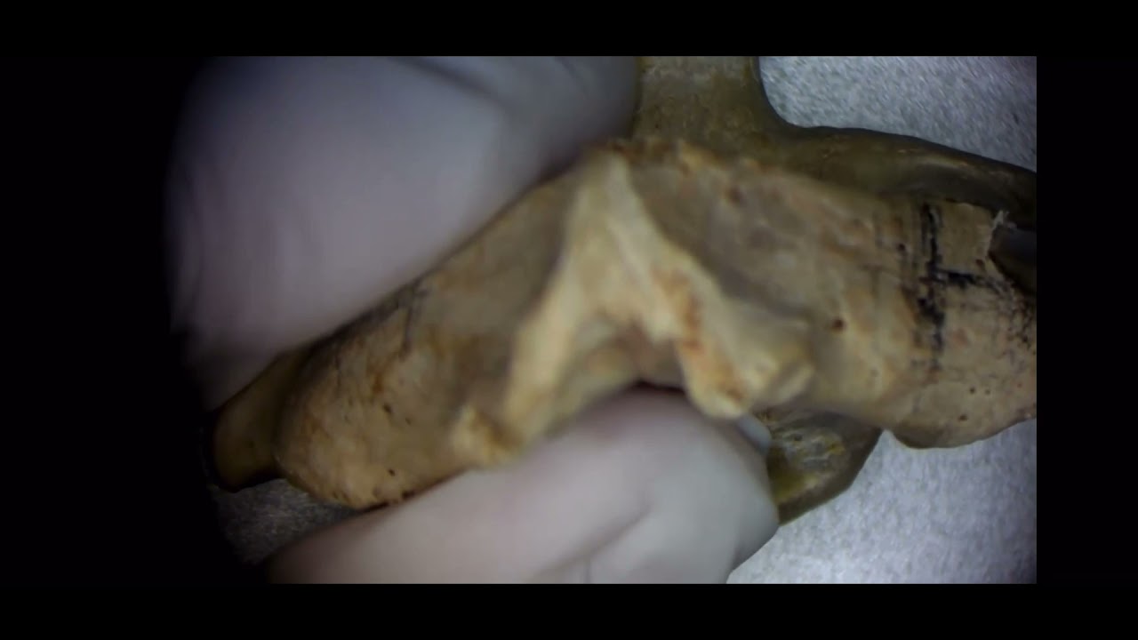 Simple technique to find the C2 pedicle entry point