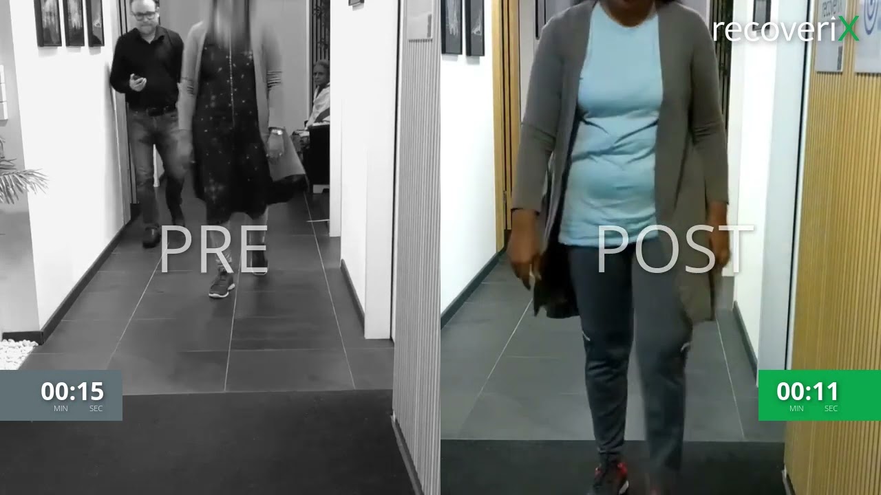Before/After recoveriX - stroke - 10MWT - ST1S